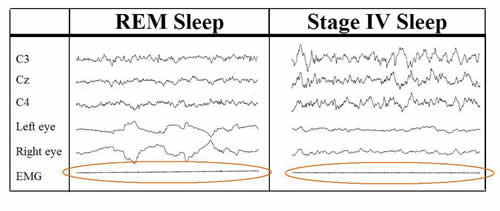 Stage-4 Sleep